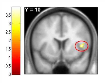 Utopian Lab window to the brain